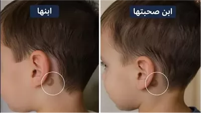 ابني وابن أقرب صاحبة ليا اتولدوا بنفس الوحمة حكايات صابرين محمد